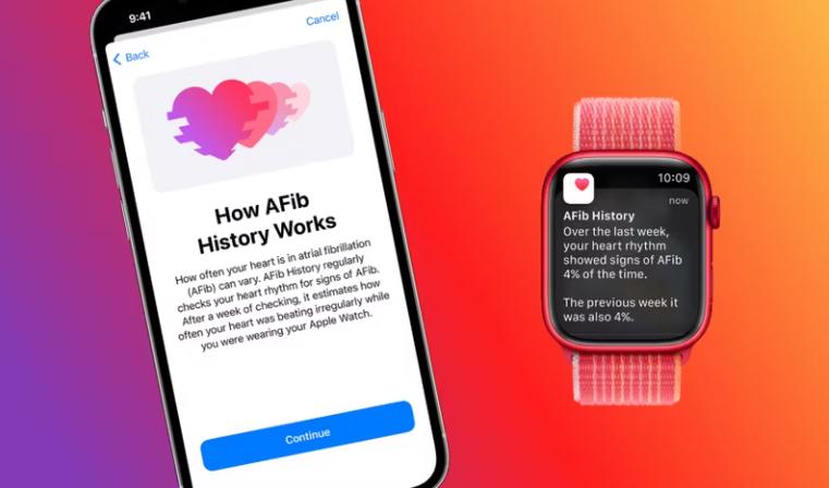如何在苹果Watch手表上设置和使用AFib历史记录
